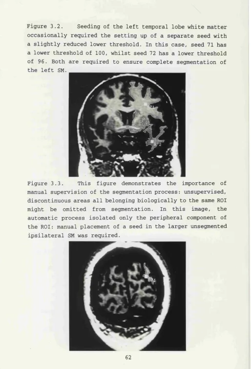 Figure 3.2. 