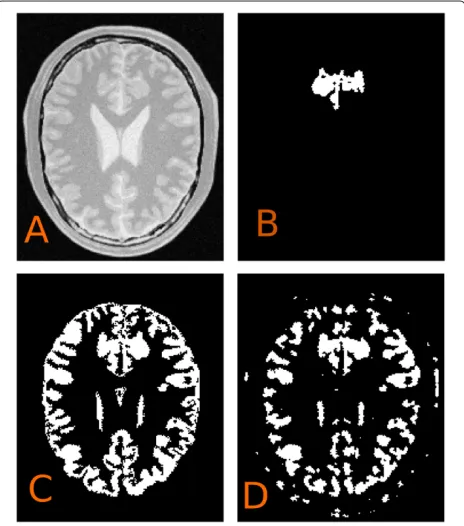 Figure 5 Validation of fast LS evolution. (A) CV and (B) GAR flow. Red corresponds to the numerical PDE solution while blue corresponds to thefast LSM