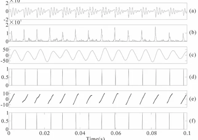 Figure 9the Hilbert envelope of the LP residual of a speech seg-