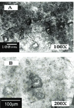 Figure 10. A&B Optical micrographs of the metal matrix composites Al&10-wt%SiC. 