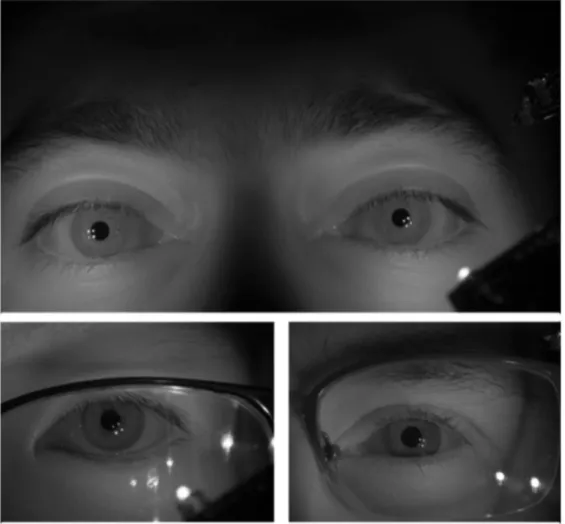 Figure 2.1: Grayscale version of the image captured with the setup(Top row).Bottom row contains cropped version of left eye for different subjects with corrected glasses[3]