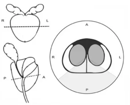 Figure 1 schematic representation of the prostate.Notes: On the two images on the left, the dashed lines indicate the equator region of the prostate from which slides were taken