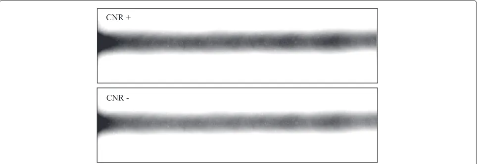 Figure 17 Experimental radiographs. Experimental radiographs of the weld for both CNR cases