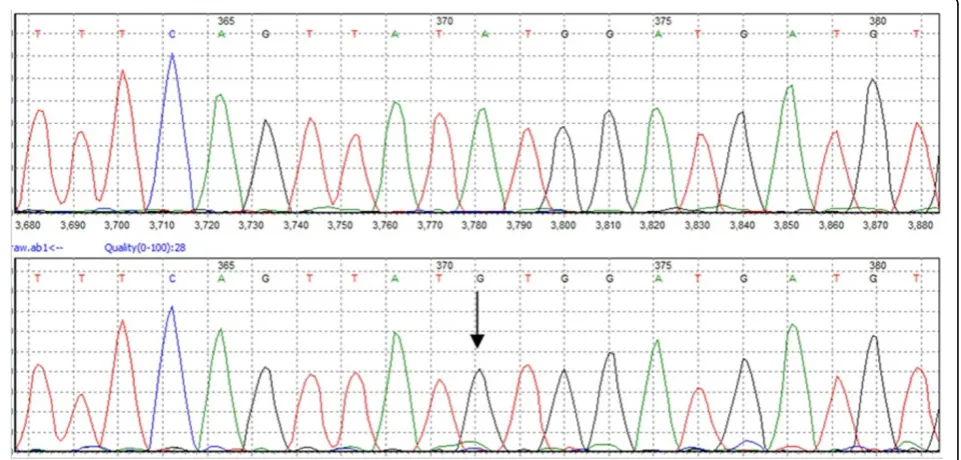 Figure 7 Recombinant analysis results of AF297620. AF297620 was failed to be genotyped by partial S gene sequencing because it hadrecombinant sites in partial S gene region.