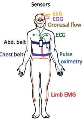 Figure 1: Polysomnography analysis
