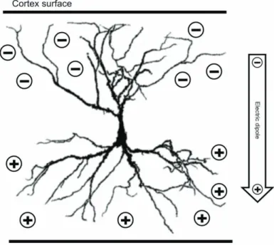 Figure 6: A cortical pyramidal cell with net charges marked by + and -. A relatively  larger amount of inhibitory synapses close to the cell body gives a surplus of positive  ions, while a relatively larger number of excitatory synapses in the dendrites cl