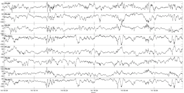 Figure 8 - Figure 11 were produced using a notch filter at 50 Hz, a low- low-pass filter at 70 Hz and a linear detrend filter