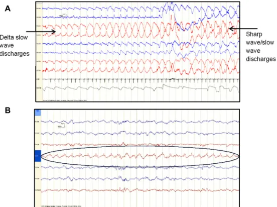 Fig. 3b indicates how the number of false detections vary with SDA threshold sensitivity (0.4 = most sensitive, 0.6 = least  sensi-tive) for the 3 most common causes