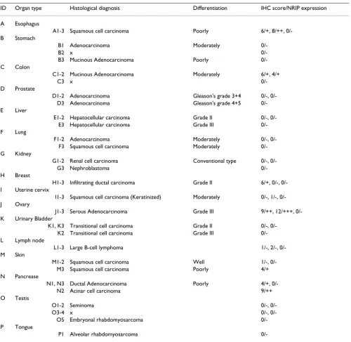 Table 1: NRIP expression in 48 cores of tumors in US Biomax BCN962 tissue microarray