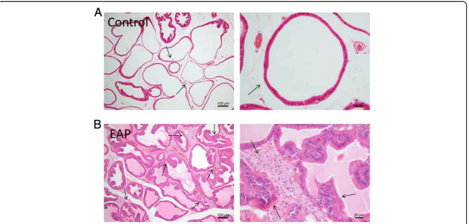 Fig. 1 Histopathological features of ventral prostate tissue in control and EAP rats. In the normal rat, the glandular epithelium structure ofprostate glands was integrated and clear without inflammatory cells infiltration and tissue hyperplasia (a)