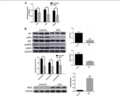 Fig. 6 Expression of AR, eNOS, AKt mRNA and protein in corpus cavernosum endothelial cell