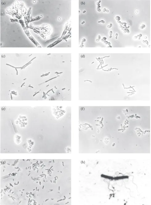Figure 2.2  Photograph of microbial morphology. (a) Molds: conidial head of Penicillium sp