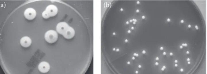 Figure 2.3  (See color insert.) Colony formation by Gram-positive (a) Bacillus thuringiensis on BACARA chromogenic  media from bioMérieux and Gram-negative (b) Klebsiella pneumoniae on XLT-4 (Xylose-Lysine-Tergitol-4) agar media  representing different col