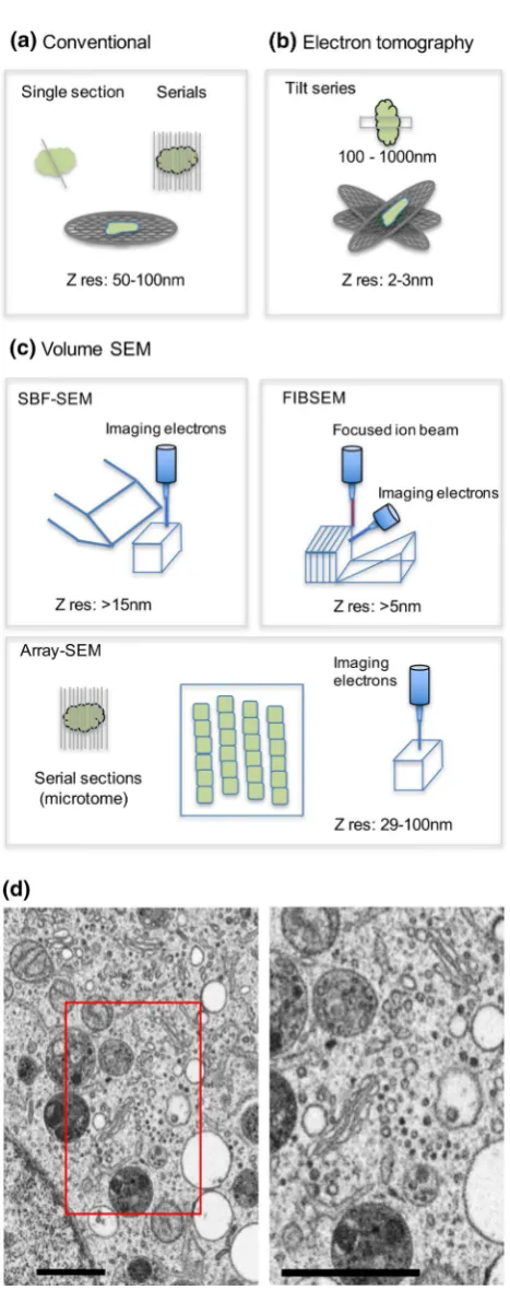 Fig. 1  New volume-SEM techniques compared to conventional and ness between 5 and 30 nm and work by iterative removal of sample block-face by physical slicing (SBF-SEM) or by ion beam erosion (FIBSEM), followed by imaging in the SEM