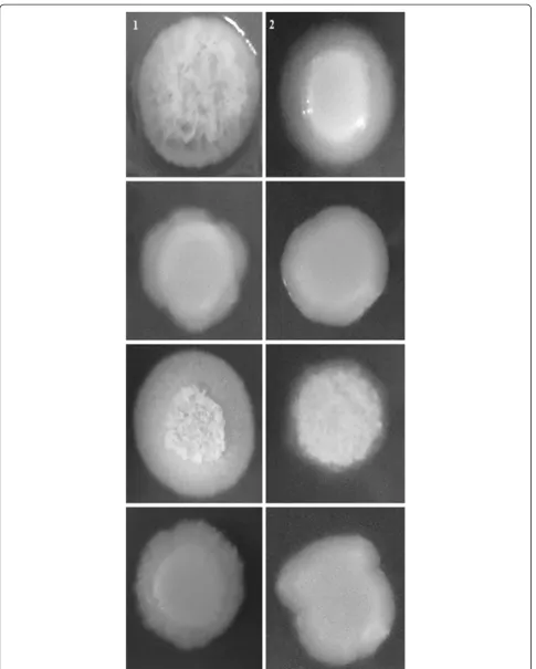 Figure 5 Different phenotypes of hypha formation on N-acetyl-D-glucosamine of Candida albicans clinical isolates obtained from theoral cavity of kidney transplant recipients