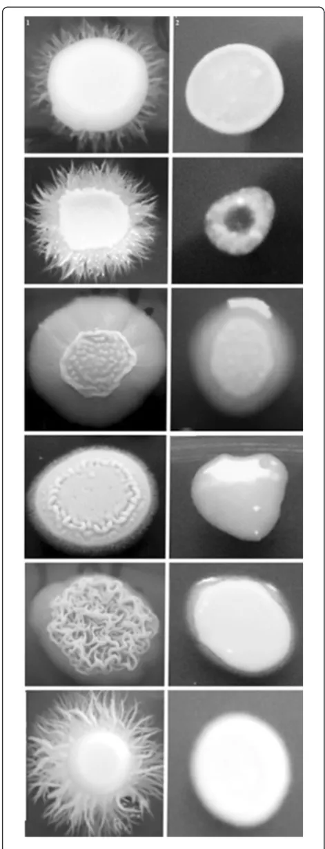 Figure 4 Different phenotypes of hypha formation on Spidermedium of Candida albicans clinical isolates obtained from theoral cavity of kidney transplant recipients