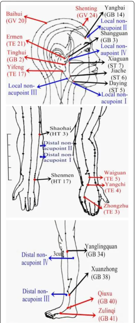 Figure 2 The points used in the trial.