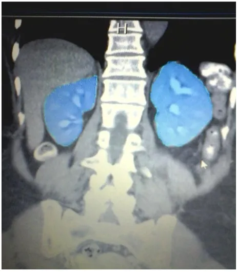Figure 3.2:   Clinical MDCT images  