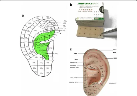 Fig. 3 A demonstration of interventions in the trial.in this trial. a A map of auricular acupoints commonly used