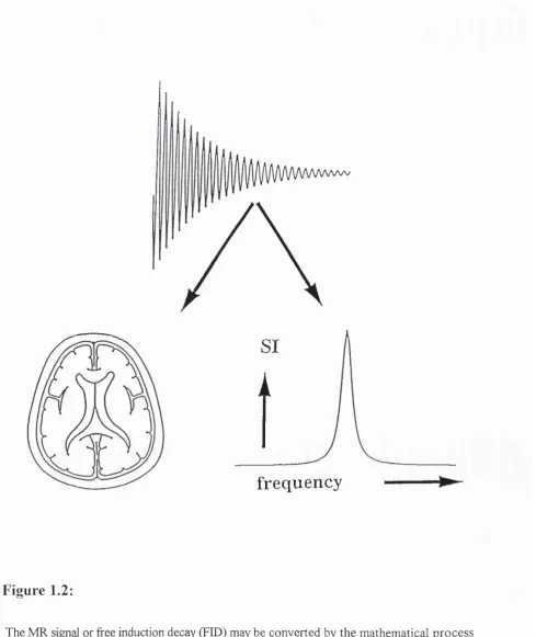 Figure 1.2:The MR signal or free induction decay (FED) may be converted by the mathematical process 