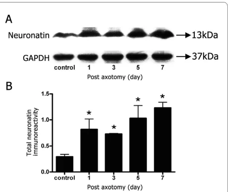 Figure 2 Total neuronatin protein contents (Nnat-α and Nnat-β) at different time points after axotomy of sciatic nerve in adult rats
