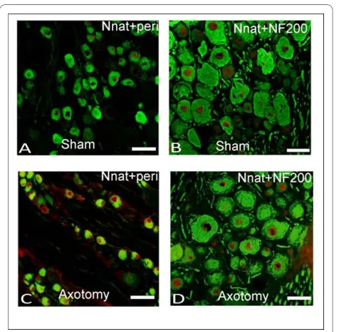 Figure 4 Statistical analysis of immunohistochemistry of DRG (marker for large myelinated A-β fiber neurons) antibodies were used to differentiate subpopulation of DRG neurons