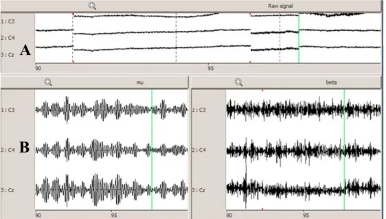 Fig. 4.  Chunk of signal in run-time of OpenViBE designer at electrode positions C3, C4 and Cz (green pointer indicates run-time of each epoch)