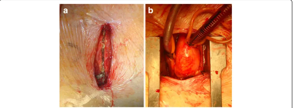 Fig. 1 Ministernotomy extended in a J-shape into the right fourth intercostal space. a Before sawing