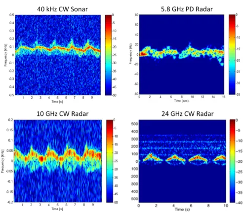 Fig. 8. Measured spectrograms of a single person using a wheelchair.