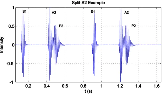 Figure 1-6: PCG with a split S2 [heart_sounds.m]. 
