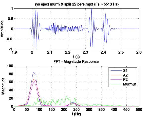 Figure 3-1: PCG spectrum [PCG_FFT.m]. 