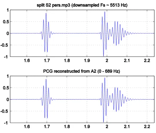 Figure 4-2: The original PCG (top subplot) has very little noise, so the filtered PCG (bottom  subplot) appears similar to the original PCG [chp4_seg.m]