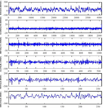 Figure 3. Wavelet coefficient for a segment of EEG signal decomposed by 4 levels DWT. 