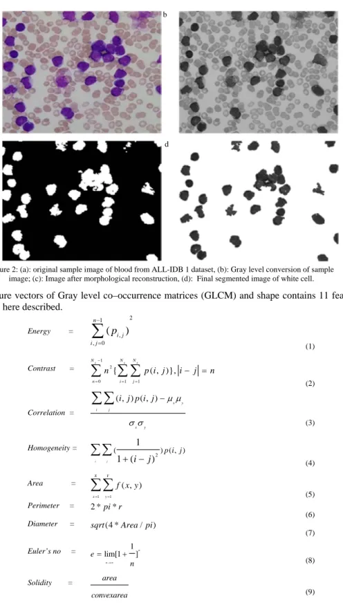 Figure 2: (a): original sample image of blood from ALL-IDB 1 dataset, (b): Gray level conversion of sample  image; (c): Image after morphological reconstruction, (d):  Final segmented image of white cell