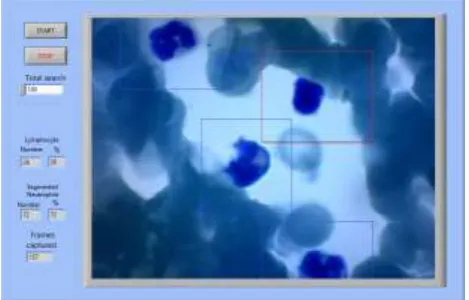 Fig. 2. Front Panel detecting Lymphocyte and Segmented Neutrophil 