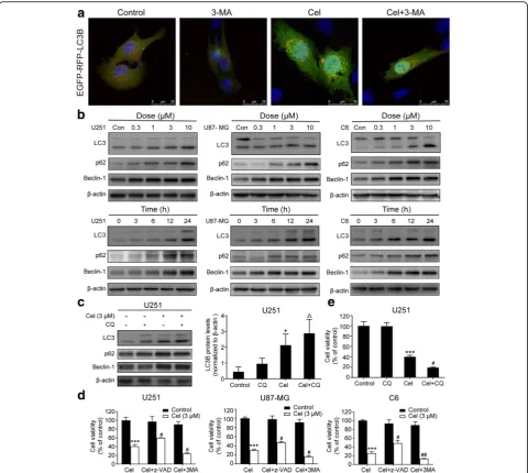 Fig. 4 Celastrol triggered autophagy in glioma cells, and inhibition of autophagy increased celastrol-induced cell death.was added to cells 2 h before celastrol treatment