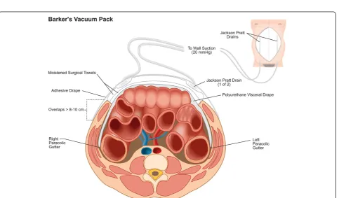 Figure 3 The ABThera™ Open Abdomen NPT System. NPT, Negative pressure therapy.