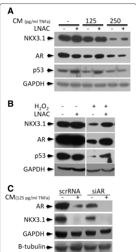 Figure 1 Antioxidant LNAC treatment restores AR, NKX3.1 andcontrol expression levels by the antioxidant LNAC (10 mM) treatment.LNAC was applied to the cells 1 h prior to the addition of CM or Hp53 expression levels