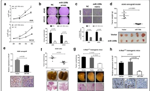 Fig. 3 Overexpression of miR-199b dramatically inhibits K-Ras mutation-driven lung tumorigenesis and progression.199b inhibited NSCLC cell metastasis in vivo