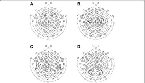 Fig. 1 Regions of interest utilized for power spectral analysis. Brain regions and electrode groupings were established based on prior literatureelectrodes included 39, 40, 45 (T3), 46, 50, and 57 on the left and electrodes 100, 101, 102, 108 (T4), 109, an