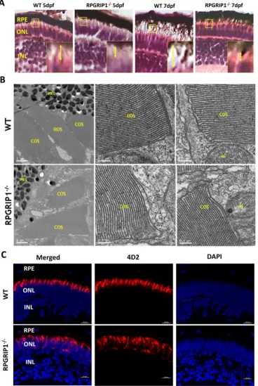 Figure 2. Rod outer segments were not developed in and inner segments were shorter in the retinas of rod cell body