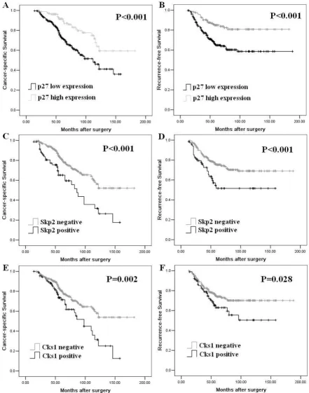 Figure 2Kip1patients with RCC were significantly associated with the expression levels of p27Kaplan-Meier survival curves according to protein expression of p27, Skp2 and Cks1Kaplan-Meier survival curves according to protein expression of p27Kip1, Skp2 and
