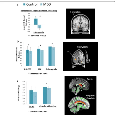 Figure 2 Summary of preliminary functional MRI data from the first 15% of participants (MDD versus controls)