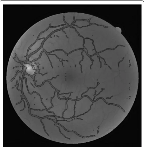 Figure 1 Retinal vessel tree extraction algorithm applied overa test image.