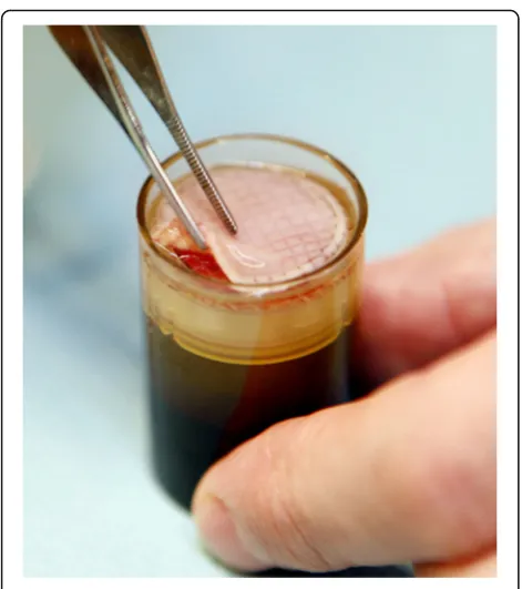 Fig. 1 A LeucoPatch® post centrifugation