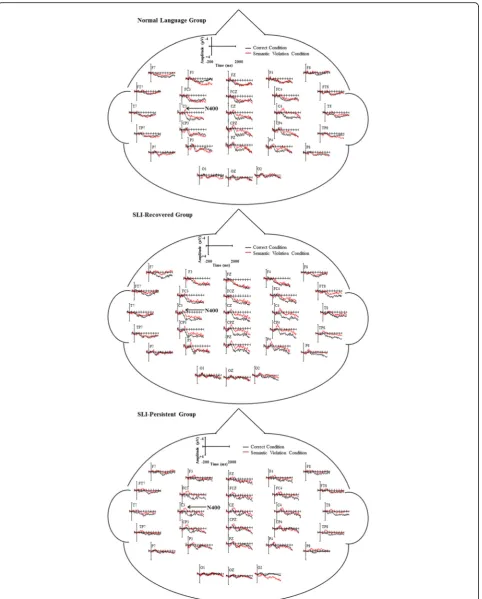 Fig. 4 Head maps by group for correct and semantic violation conditions