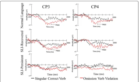 Fig. 5 Omission violation ERP group patterns