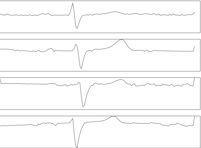 Figure 1.1: Four ECG time series from the ECGFiveDays dataset. The beginning third and final third of the series are very similar, differing only a little and seemingly at random