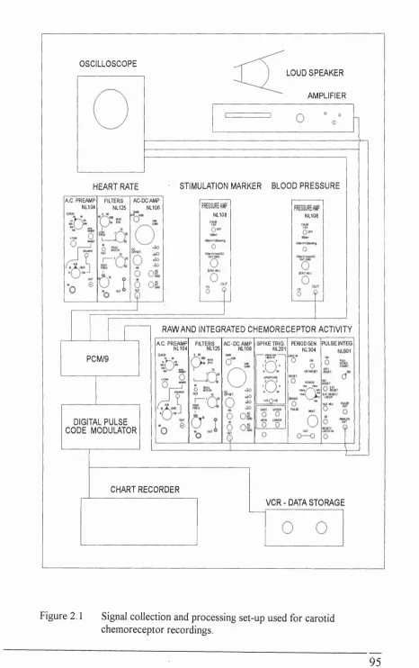 Figure 2.1 Signal collection and processing set-up used for carotid 