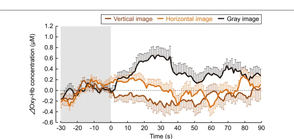 Fig. 4 Changes in the oxyhemoglobin (oxy-Hb) concentrations in the left prefrontal cortex